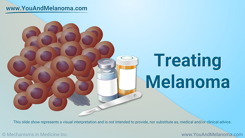 Treating Melanoma - Download Slide Show