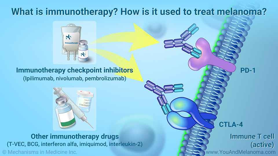 What is immunotherapy? How is it used to treat melanoma?
