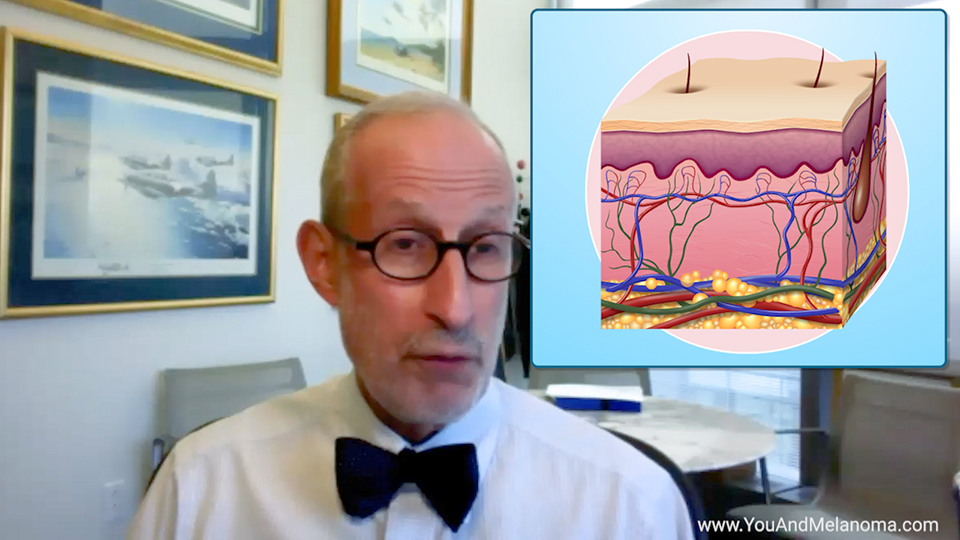 What is melanoma and what causes it?
