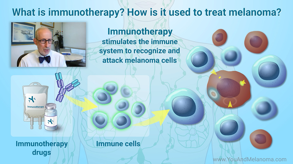 How is melanoma treated with immunotherapy?