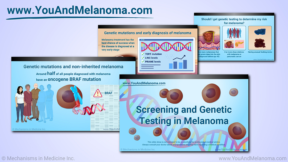 Slide Show - Genetic Mutations and Melanoma