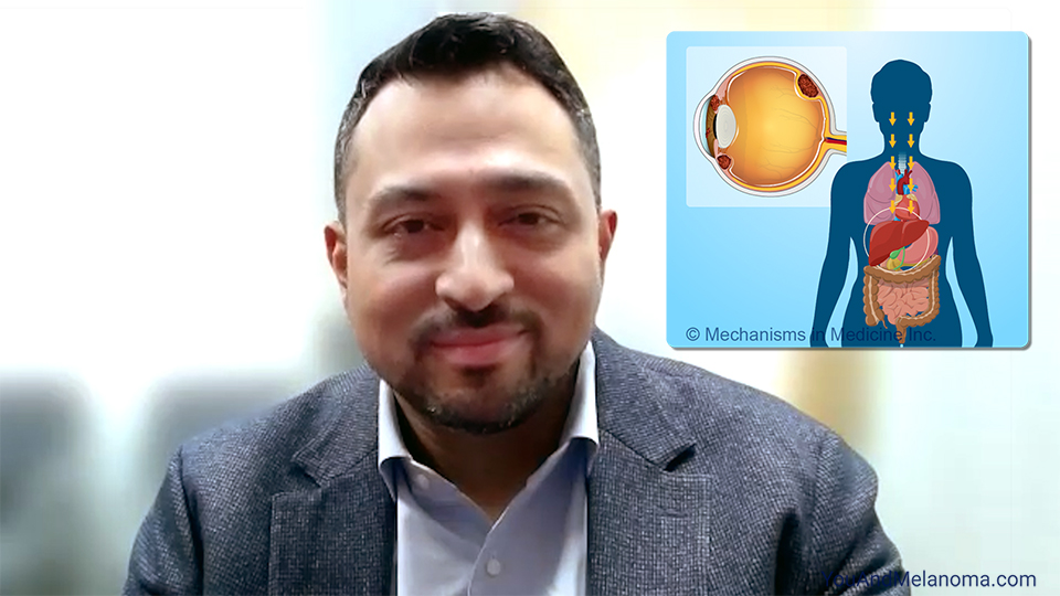 What is metastatic uveal melanoma?