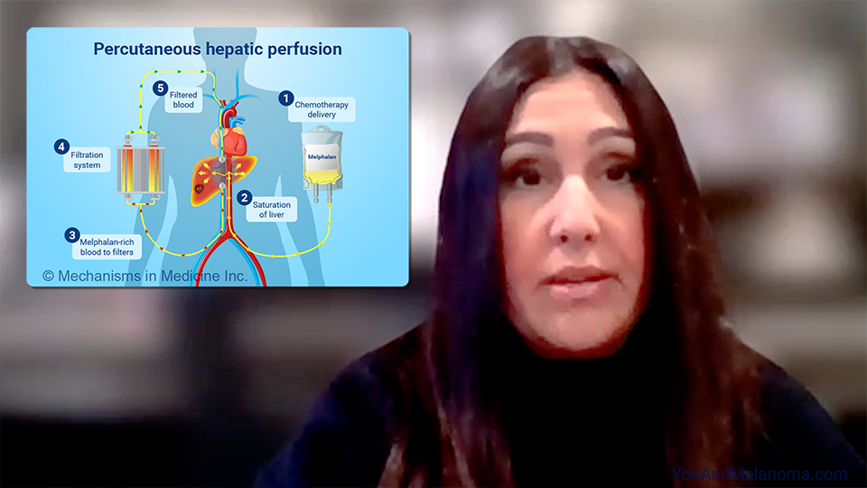 How is metastatic uveal melanoma treated?