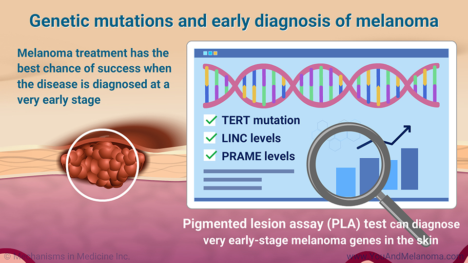 Genetic mutations and early diagnosis of melanoma