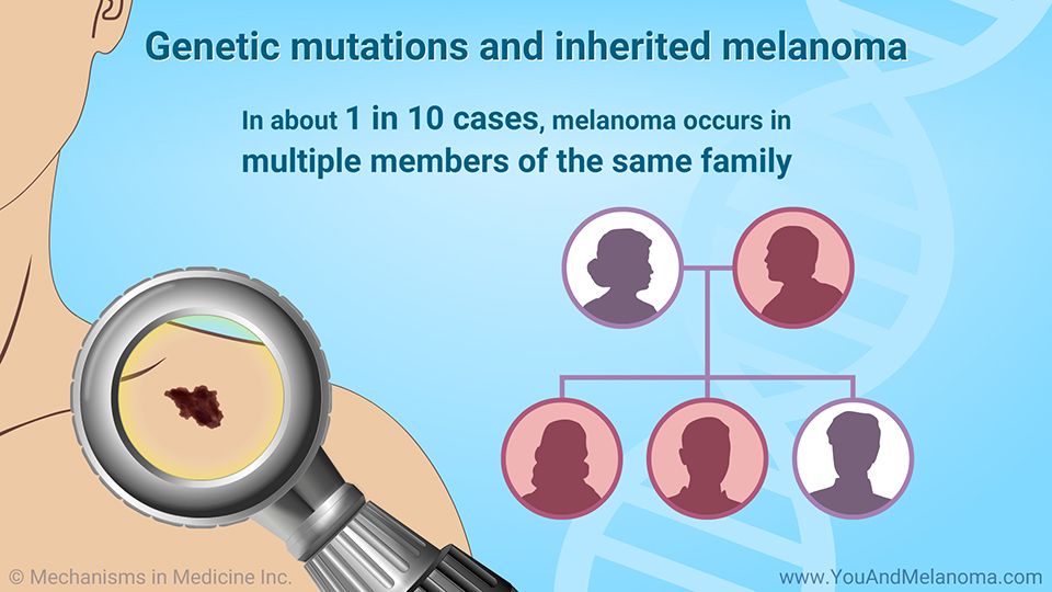 Genetic mutations and inherited melanoma