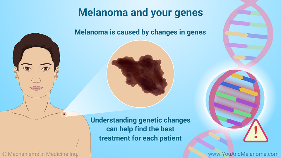 Melanoma and your genes