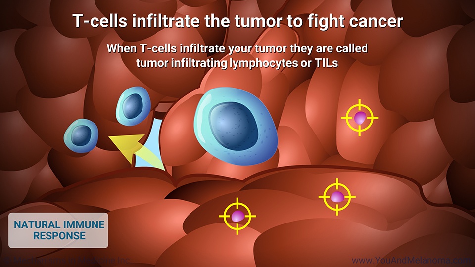 T cells infiltrate the tumor to fight cancer
