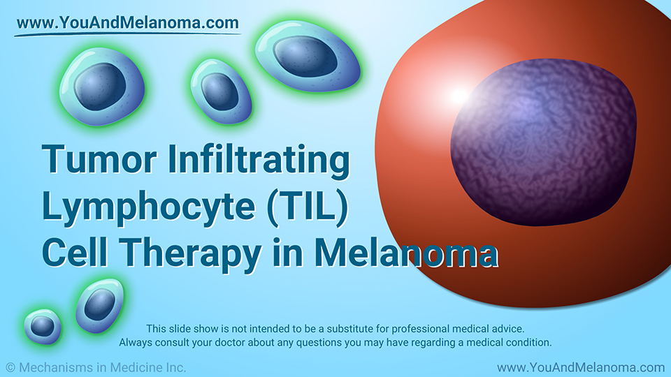 Tumor Infiltrating Lymphocyte (TIL) Cell Therapy in Melanoma