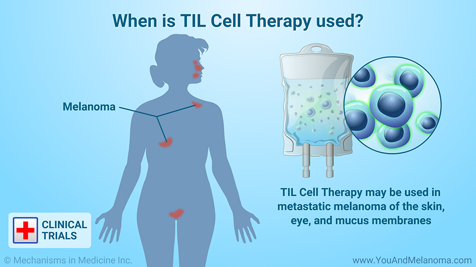 When is TIL Cell Therapy used?