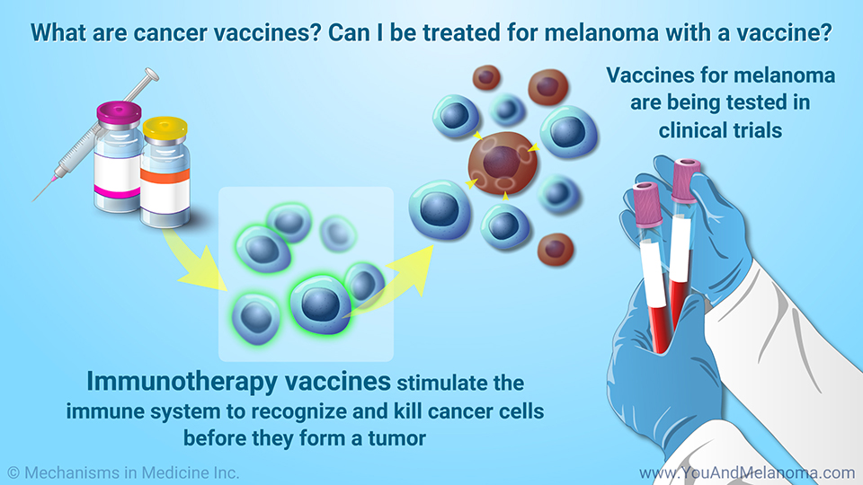What are cancer vaccines? Can I be treated for melanoma with a vaccine?