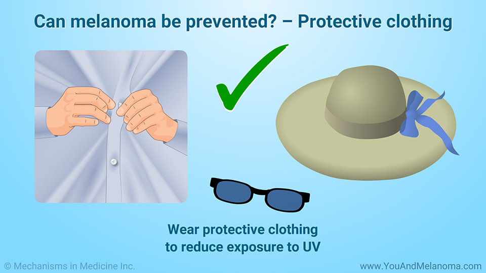 Can melanoma be prevented? – Protective clothing