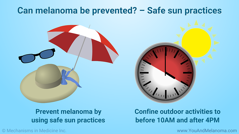 Can melanoma be prevented? – Safe sun practices