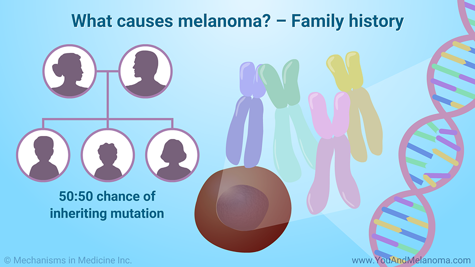 What causes melanoma? – Family history